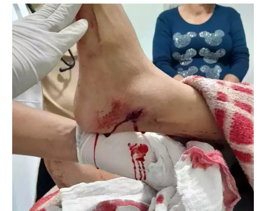 Imagem de compartilhamento para o artigo PM de MS que atirou em garoto de 12 anos é afastado do trabalho realizado nas ruas da MS Todo dia